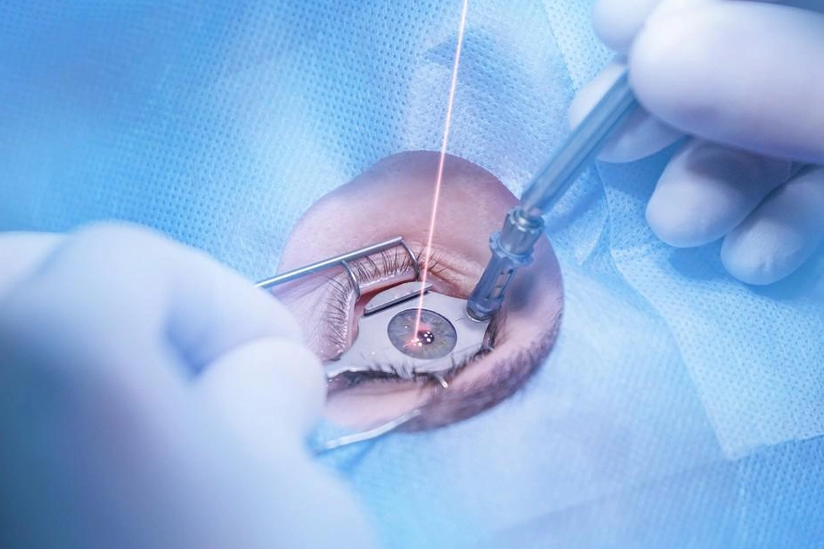 Doctor performing LASIK eye surgery in Pune with advanced laser technology