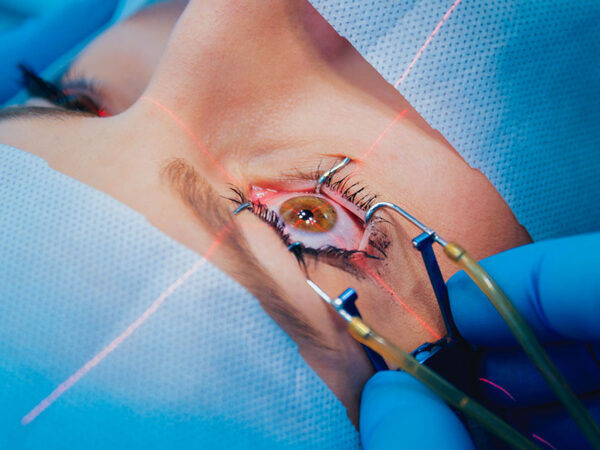 Is Laser Eye Surgery Safe in 2026? Latest Research, Technology, and What Patients Must Know